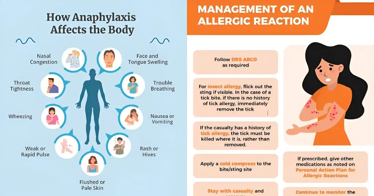 when to go to hospital allergic reaction